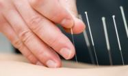 Acupuncture & Natural Medicine Clinic